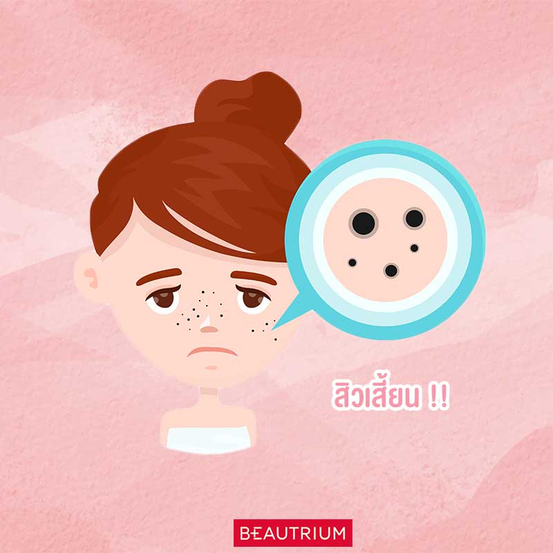 Blackhead