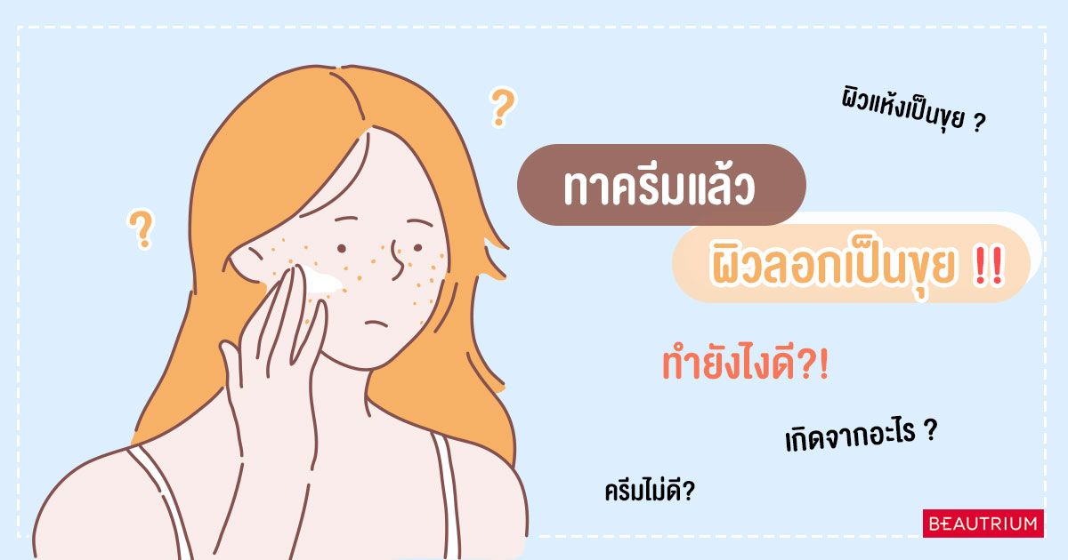 ทาครีมแล้วผิวลอกเป็นขุย ทำยังไงดีนะ ?!