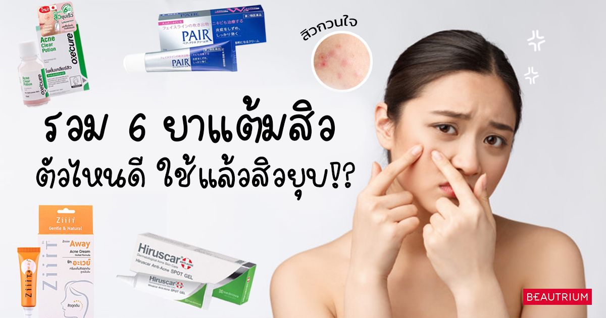 รวม 6 ยาแต้มสิว ตัวไหนดี ใช้แล้วสิวยุบ!?