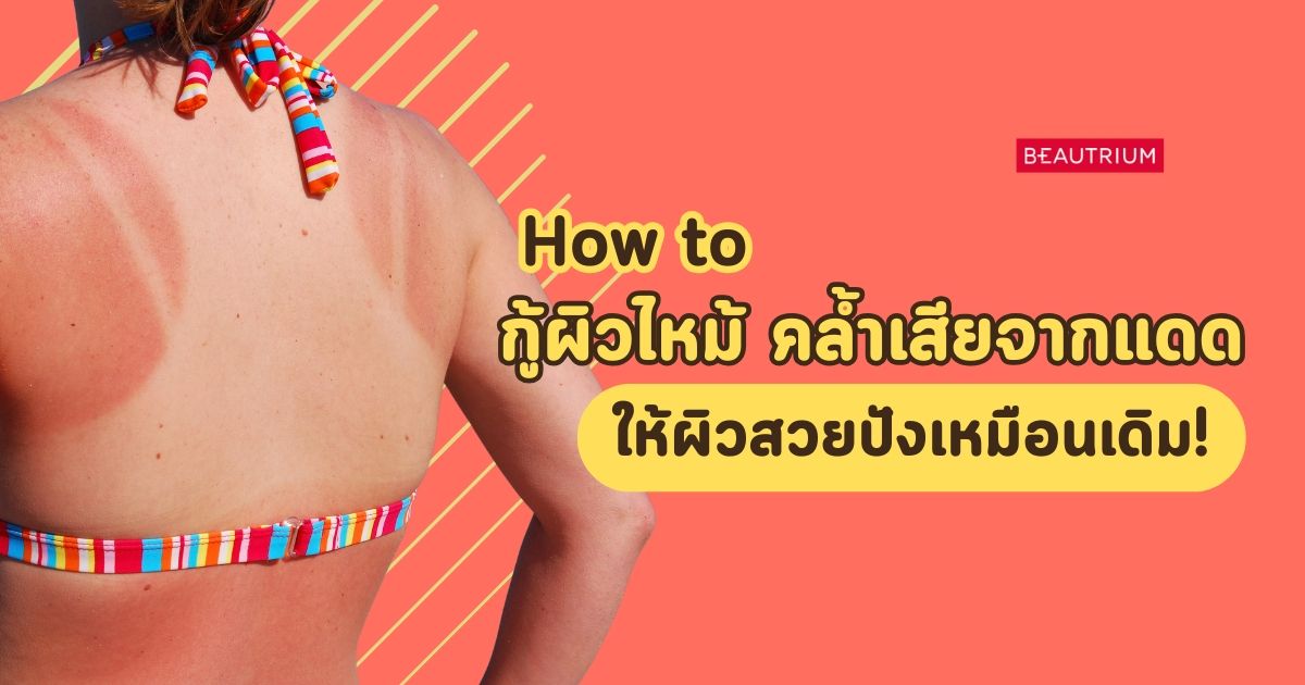 How to กู้ผิวไหม้คล้ำเสียจากแดด ให้ผิวกลับมาสวยปัง!