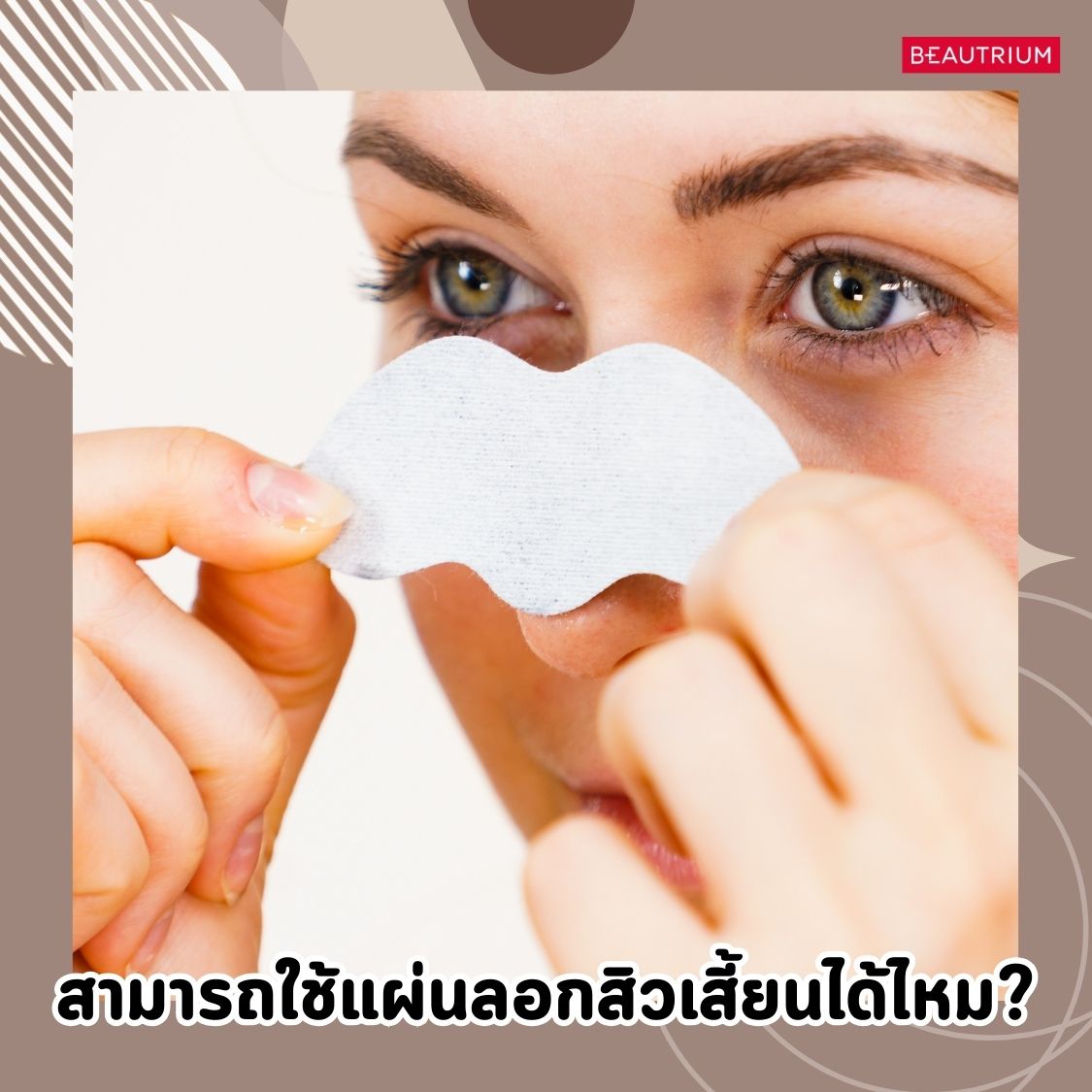  Sebaceous Filaments (เส้นใยไขมัน)