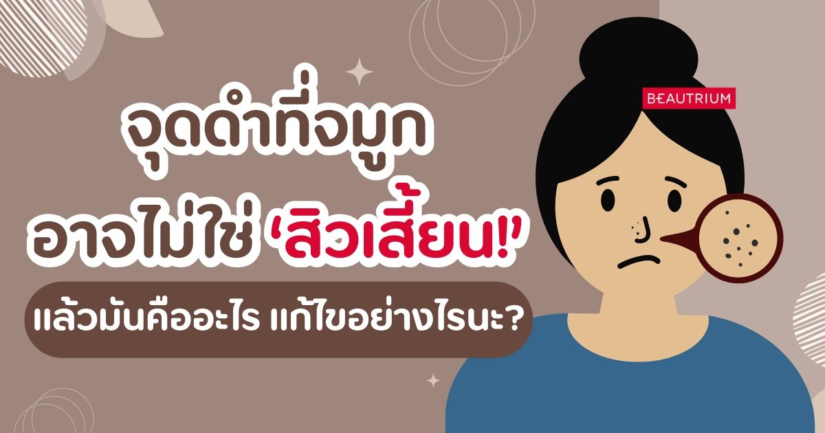 จุดดำที่จมูกอาจไม่ใช่สิวเสี้ยน! แล้วมันคืออะไร แก้ไขอย่างไรนะ!?