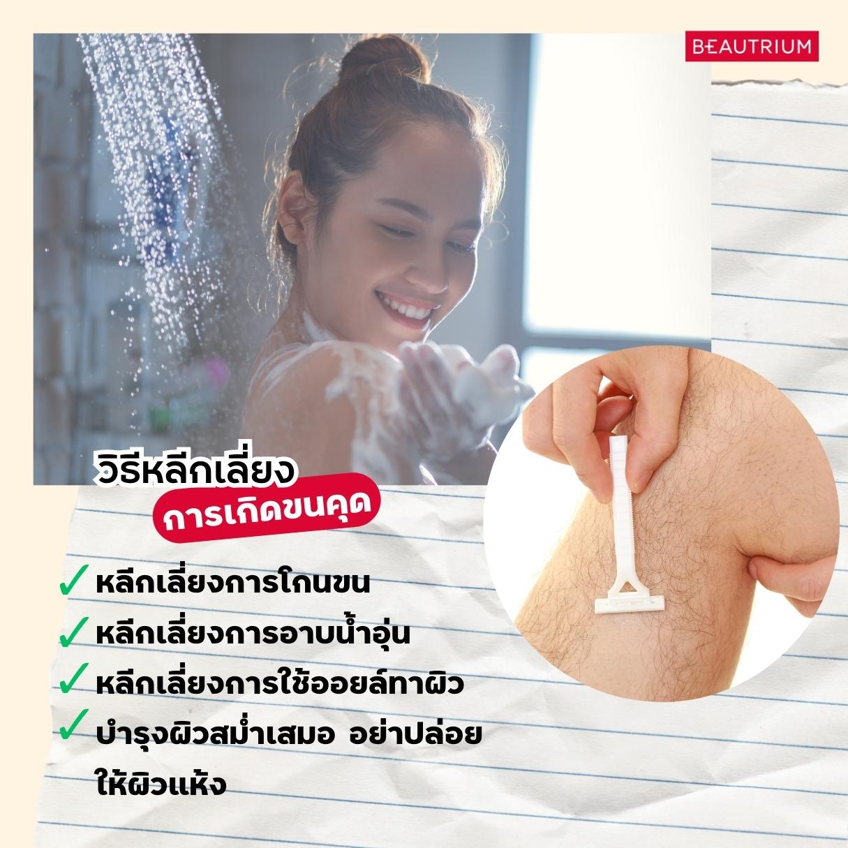 Keratosis Pilaris
